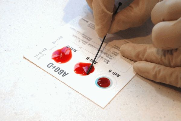 Лаборанты определят вашу группу крови.
