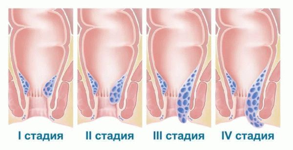 HEMO массирует живот справа налево, чтобы выпустить застрявший воздух, если он кажется вздутым.